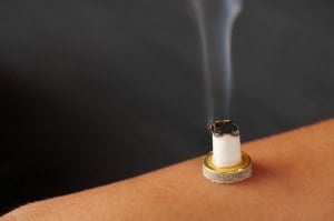 Moxibustion Therapy