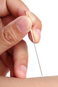 What Is Acupuncture In Berkeley,CA