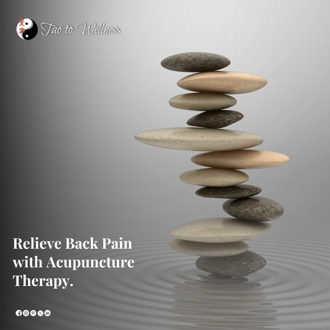 Relieve Back Pain with Acupuncture Therapy