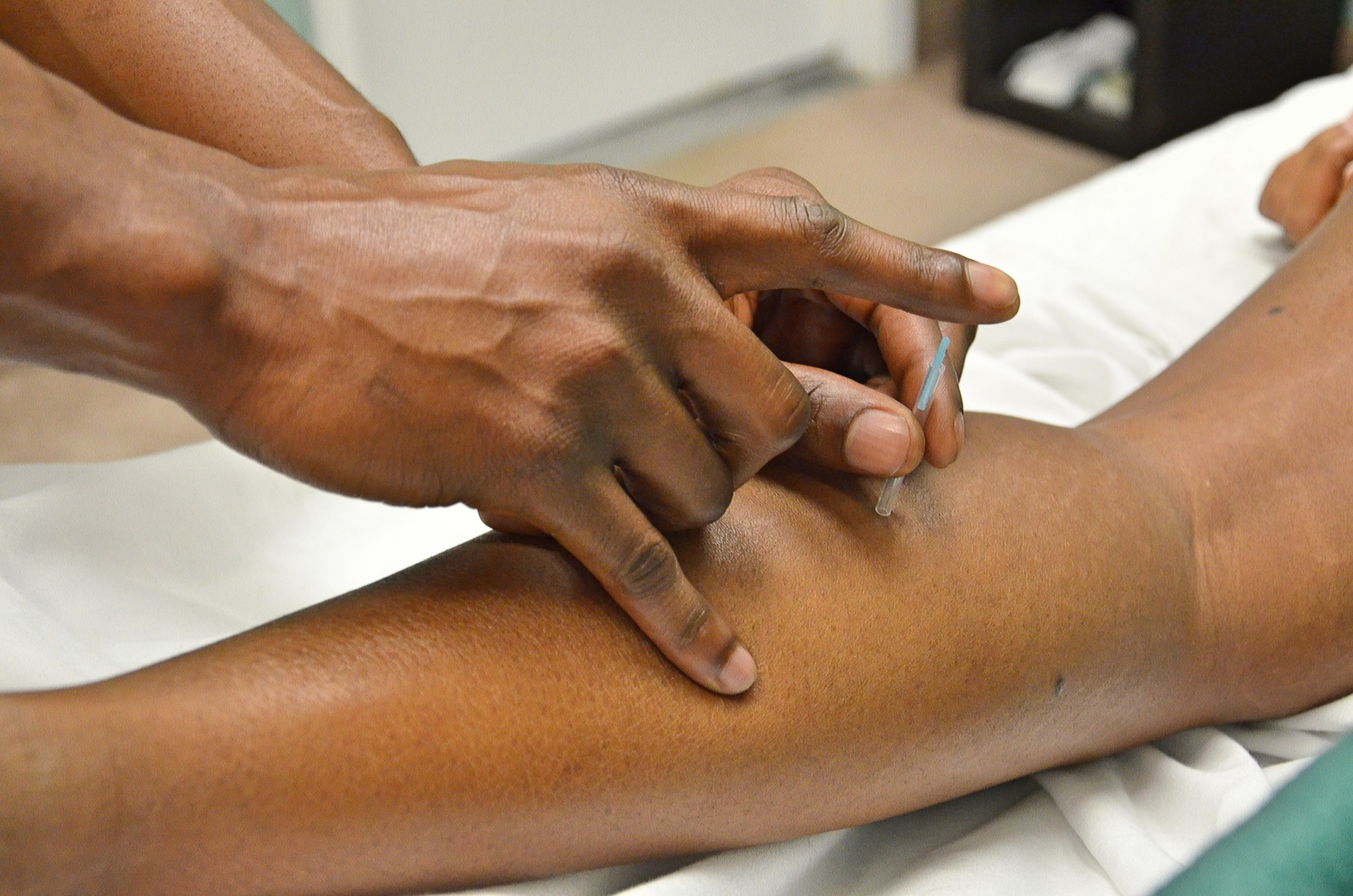 Patient getting acupuncture at Tao to Wellness in Berkeley, California