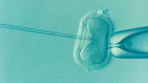 Artificial insemination or in vitro fertilization under a microscope.