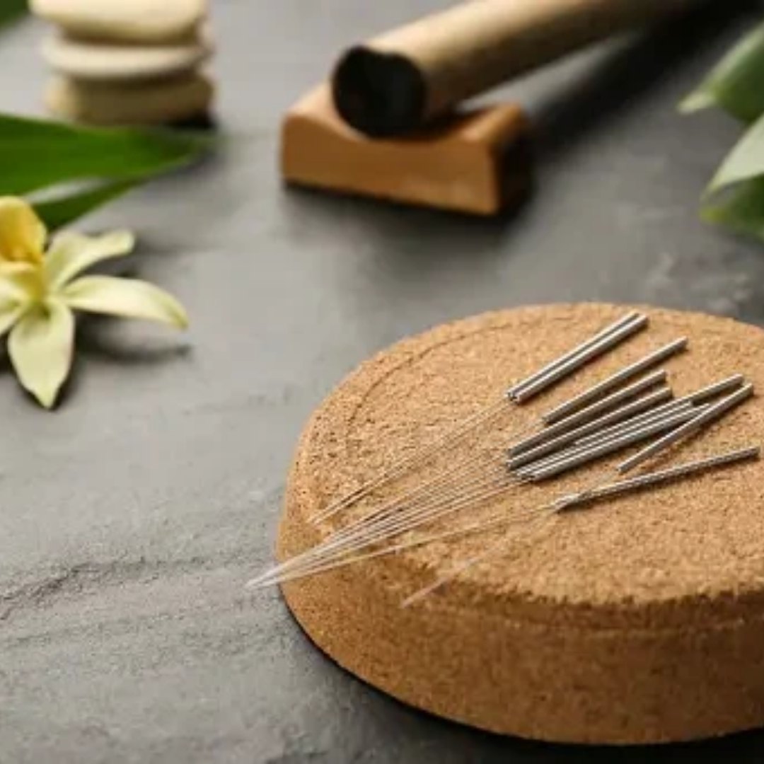 Acupuncture needles at Tao to Wellness in Berkeley