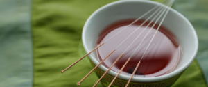 Acupuncture needles and a cup of tea at Tao to Wellness Acupuncture Center in Berkeley