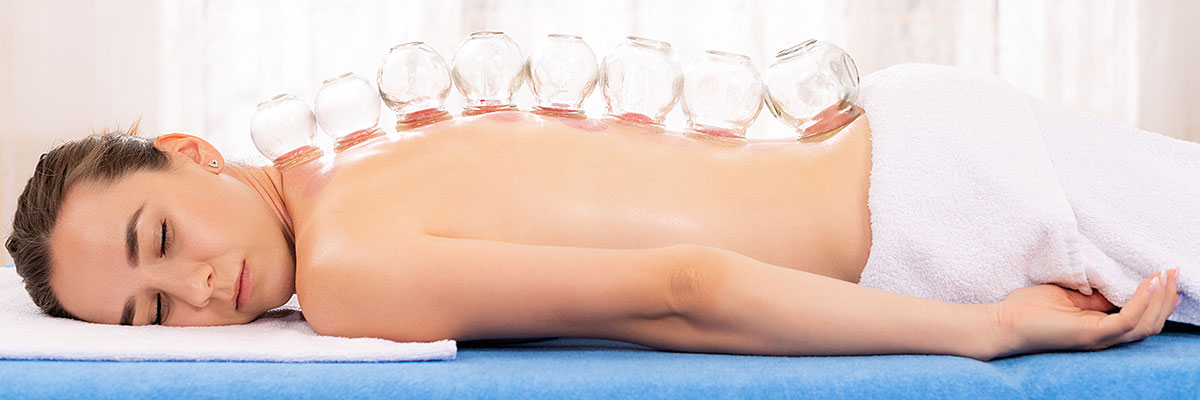 Female patient at Tao Wellness Center in Berkeley, CA relaxing during a cupping treatment.