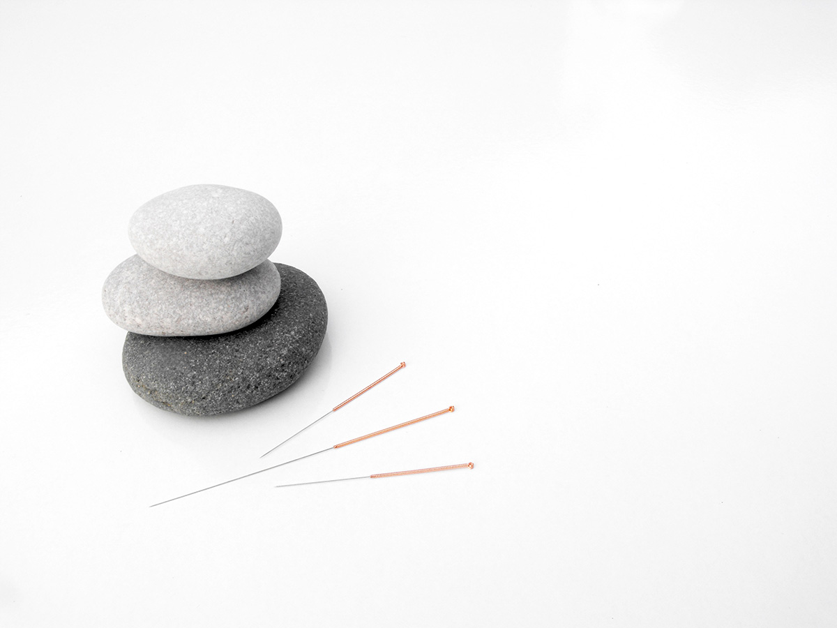 Minimalist acupuncture tools arrangement with three smooth stones stacked in a zen formation, accompanied by acupuncture needles on a white background, symbolizing balance, healing, and relaxation.