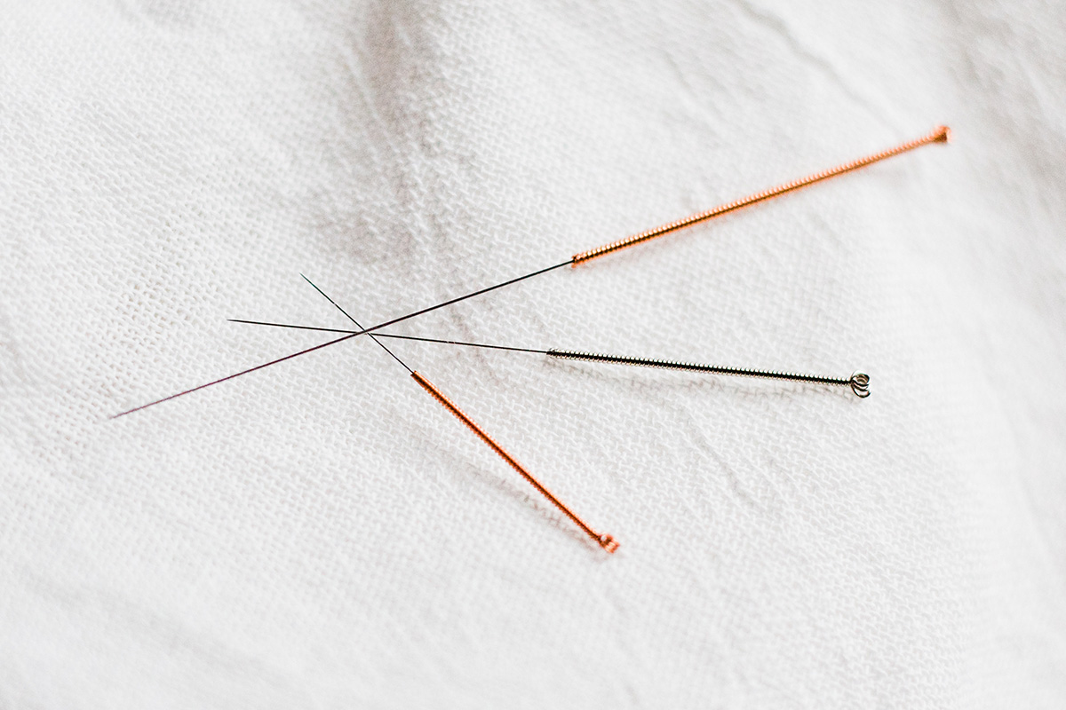 Three acupuncture needles of various sizes on white linen