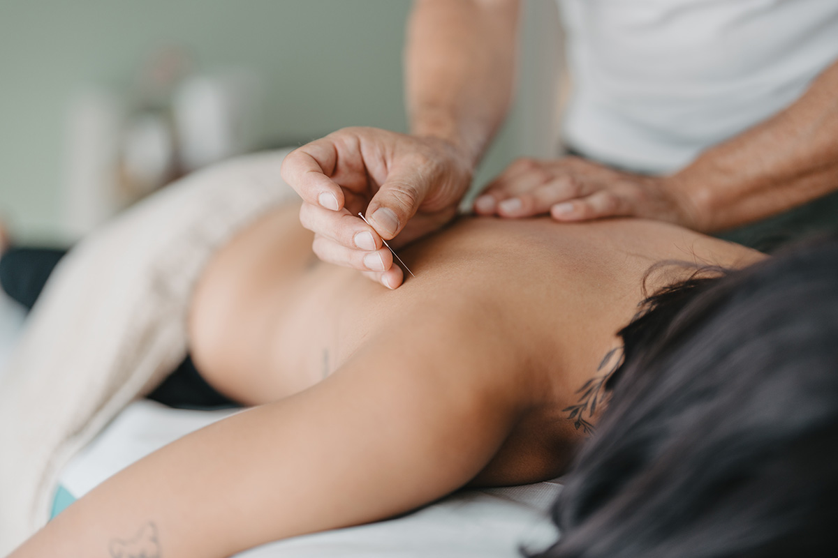 Therapist about to stick an acupuncture needle in a woman's back to treat infertility.