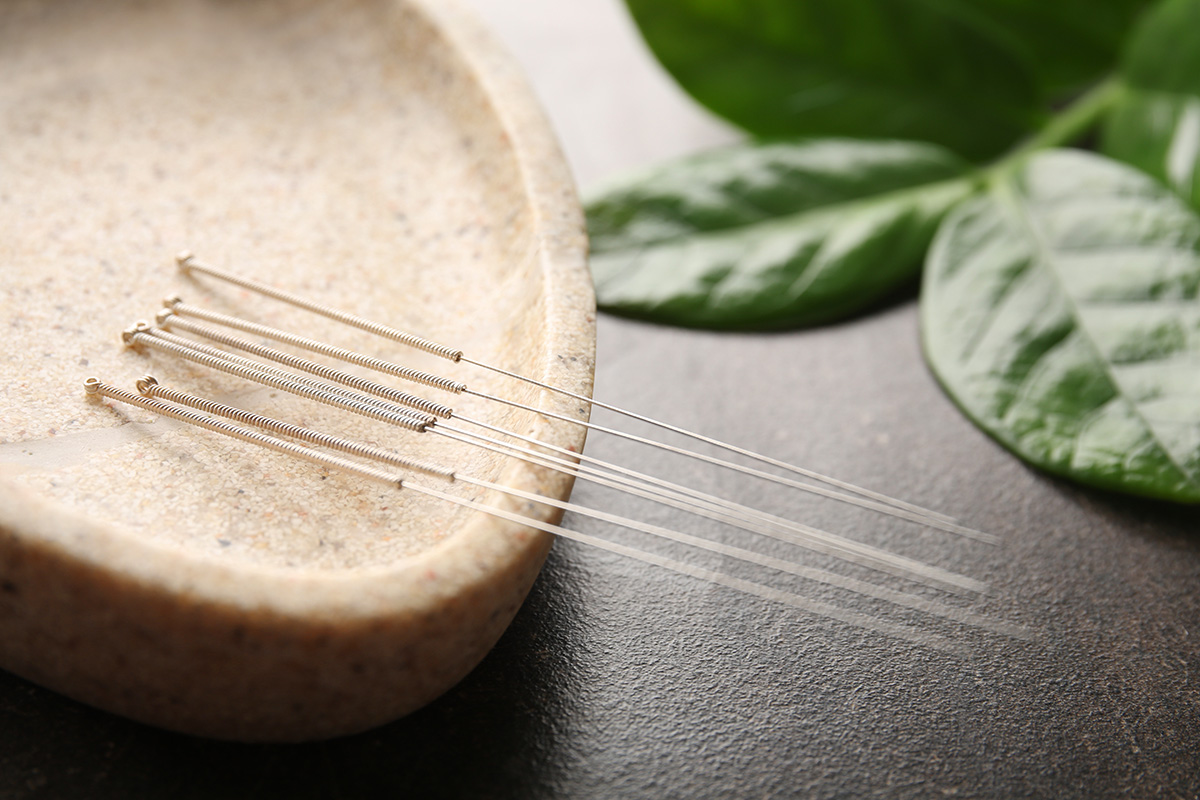 Acupuncture needles arranged on a natural stone plate with green leaves in the background, representing holistic healing and wellness.