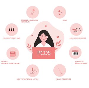 Infographic showing PCOS symptoms in women, including infertility, acne, excessive body and hair loss, obesity, irregular periods, high testosterone levels, and insulin resistance.