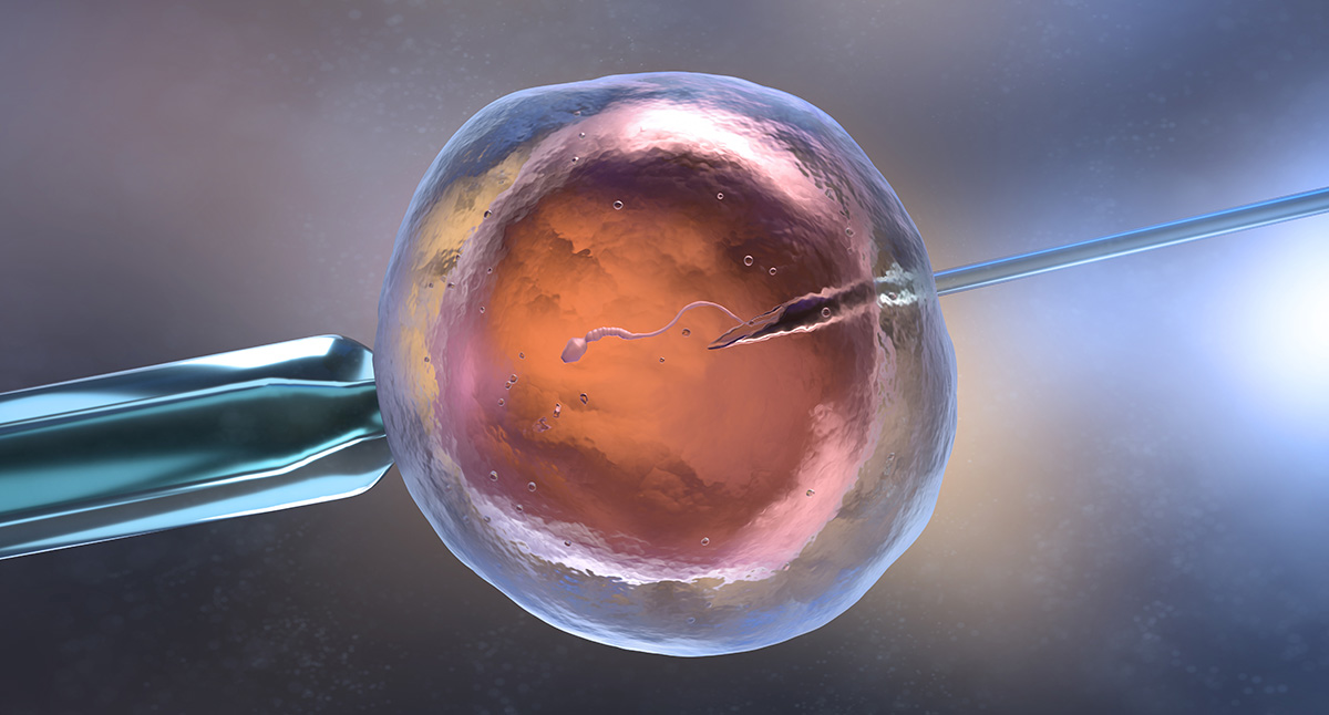 Artificial insemination or in vitro fertilization.