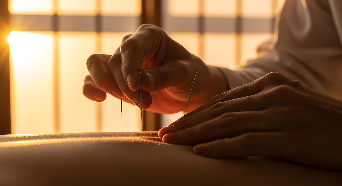 Serene acupuncture treatment 