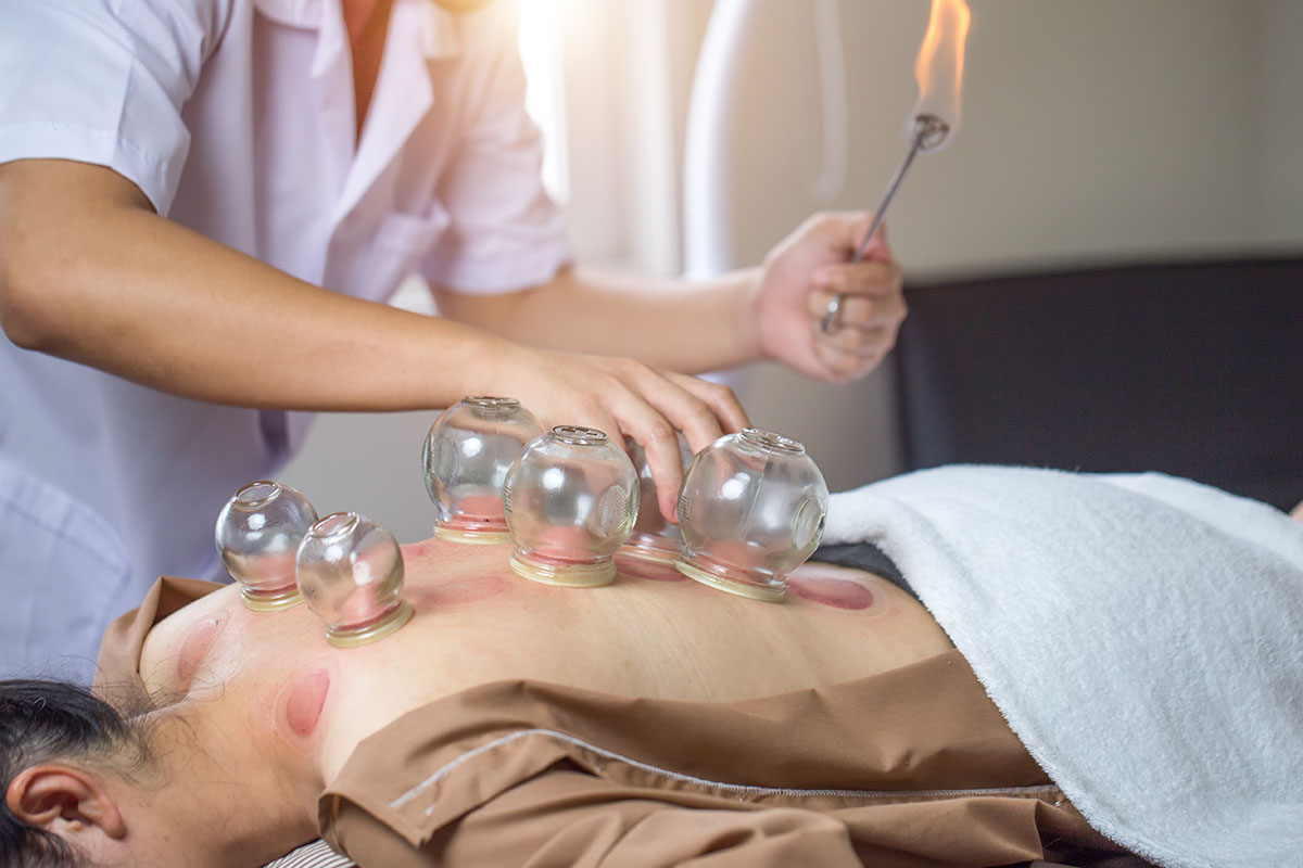 Traditional Chinese Medicine Treatment - Cupping