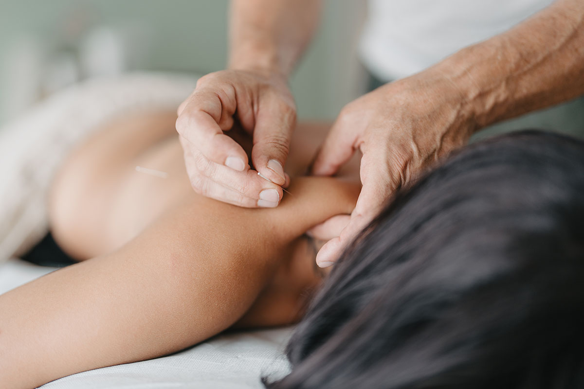 Acupuncturist pinches the patient's neck with one hand to insert an acupuncture needle 