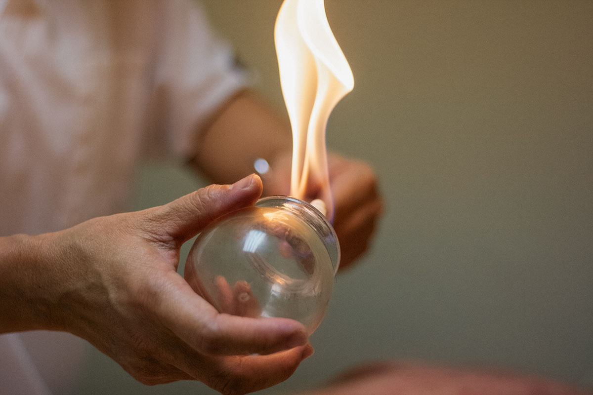 Woman preparing glass cup with flame for cupping therapy